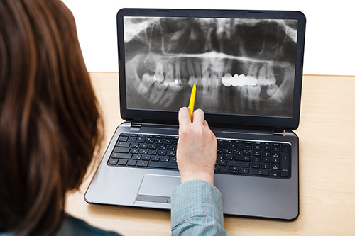 Dental Student analyzes X-ray photo of patient jaws